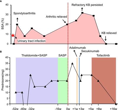 A novel approach with tofacitinib for the management of keratoderma blennorrhagicum in reactive arthritis: a case report